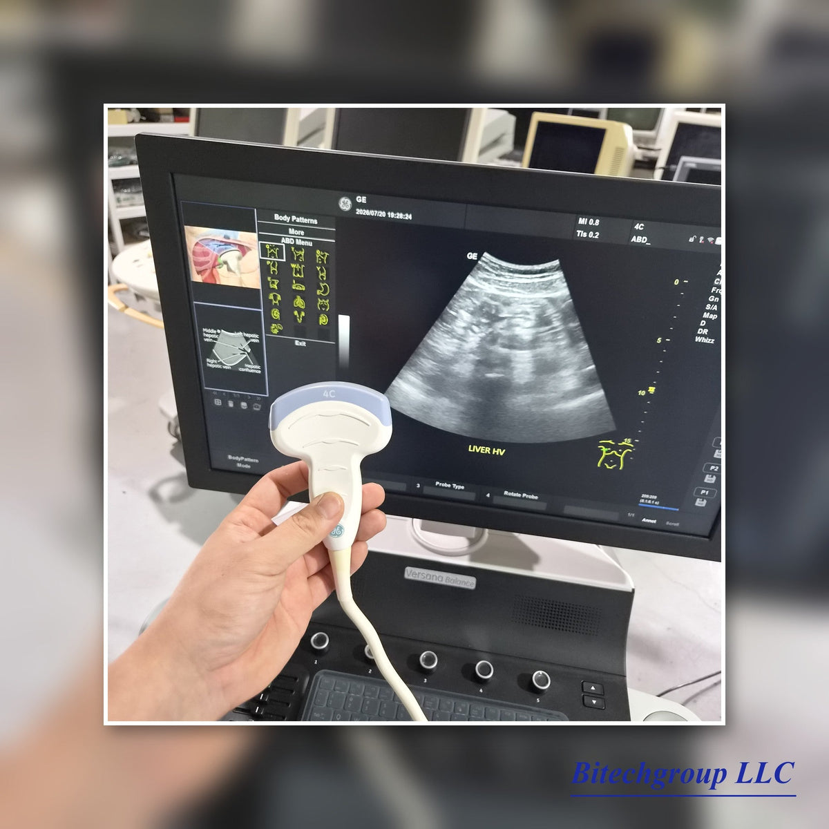 GE Versana Balance Ultrasound System — The Smart Choice for High-Volume Clinics