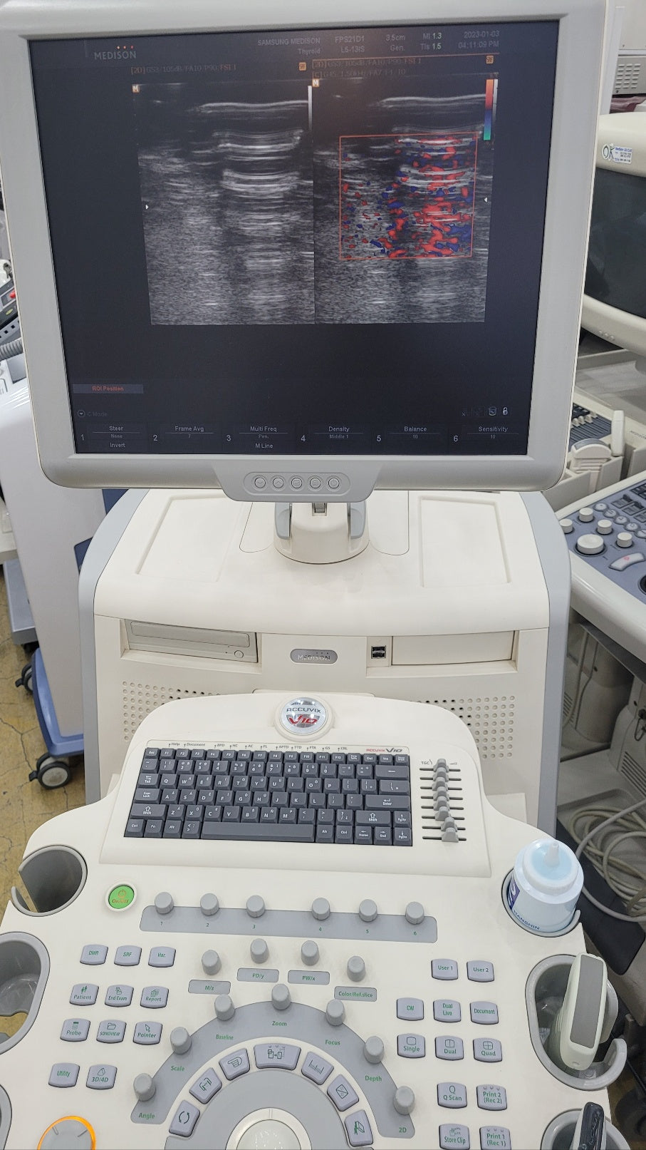 Samsung Medison Accuvix V10 Ultrasound