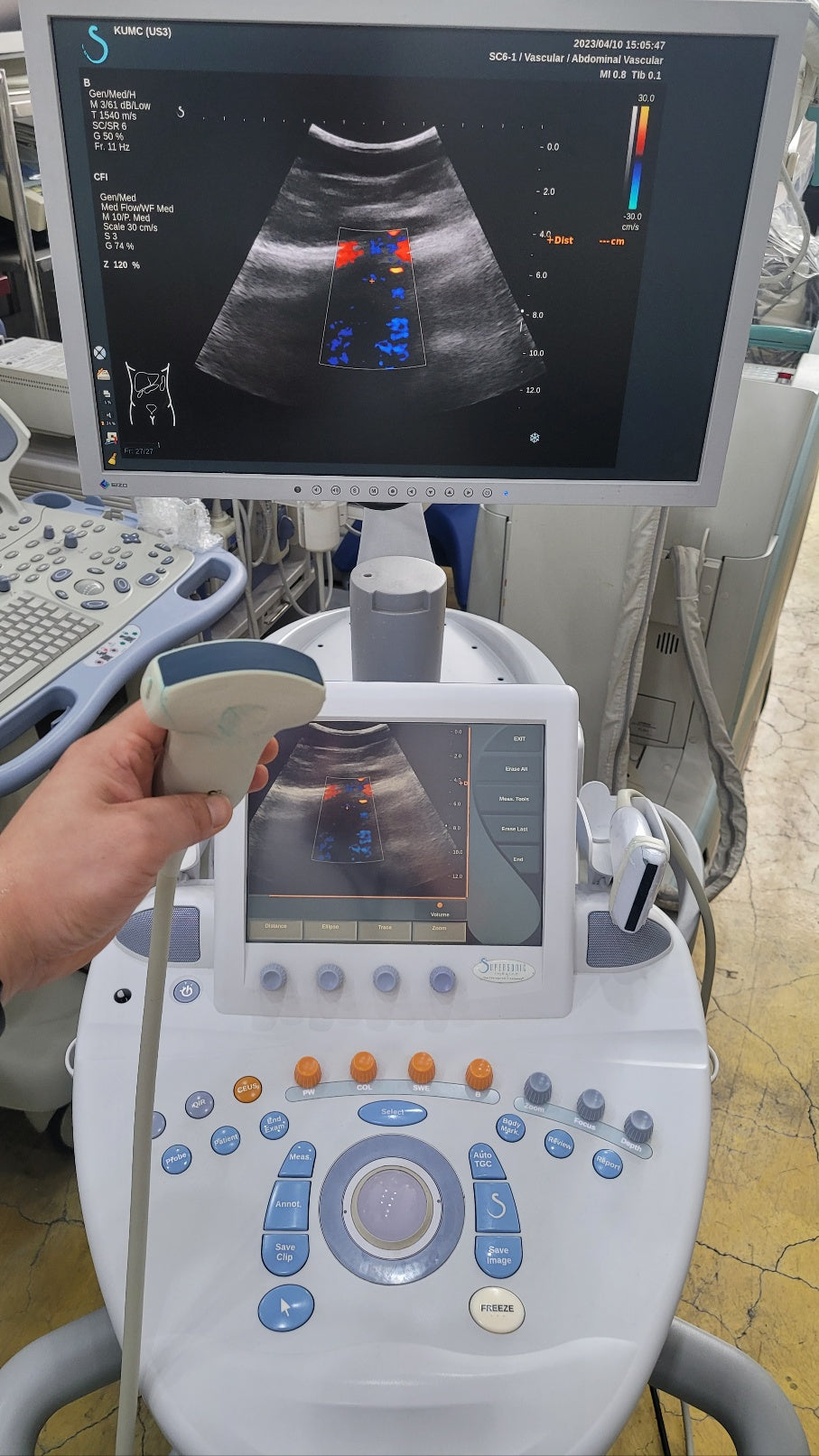 Used Supersonic Imagine Aixplorer Multiwave SC6-1 Convex Probe