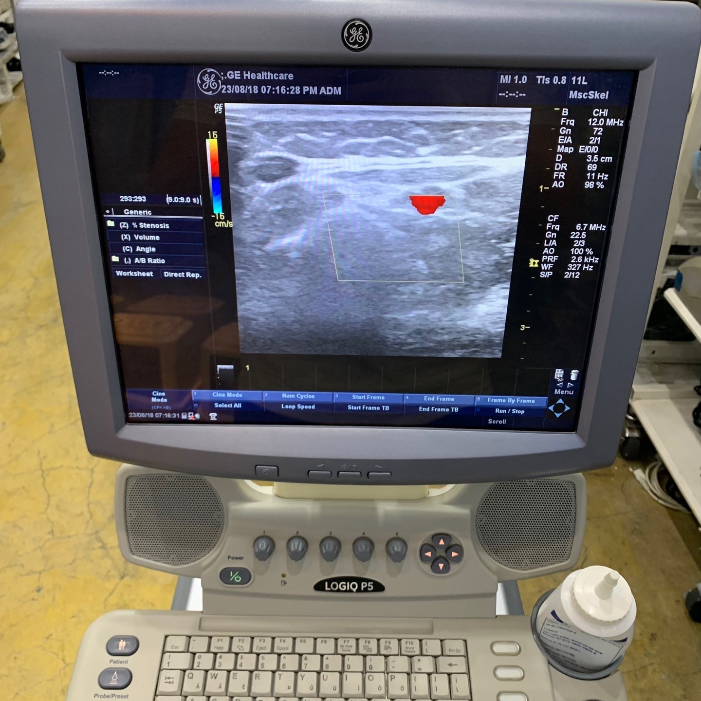 GE 11L Linear Ultrasound Probe Transducer