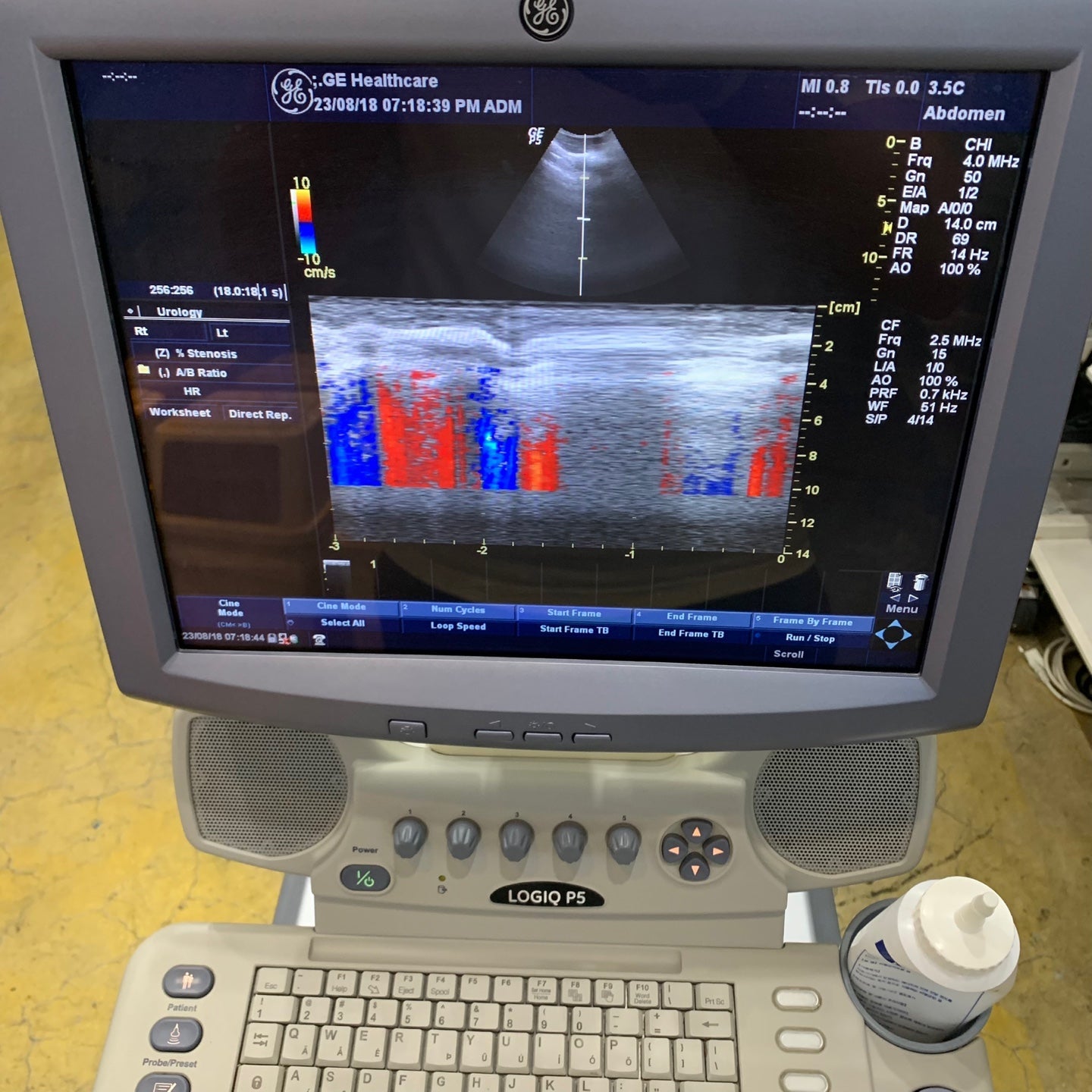 Used GE Logiq P5 Ultrasound Unit with Linear Probe Convex Probe