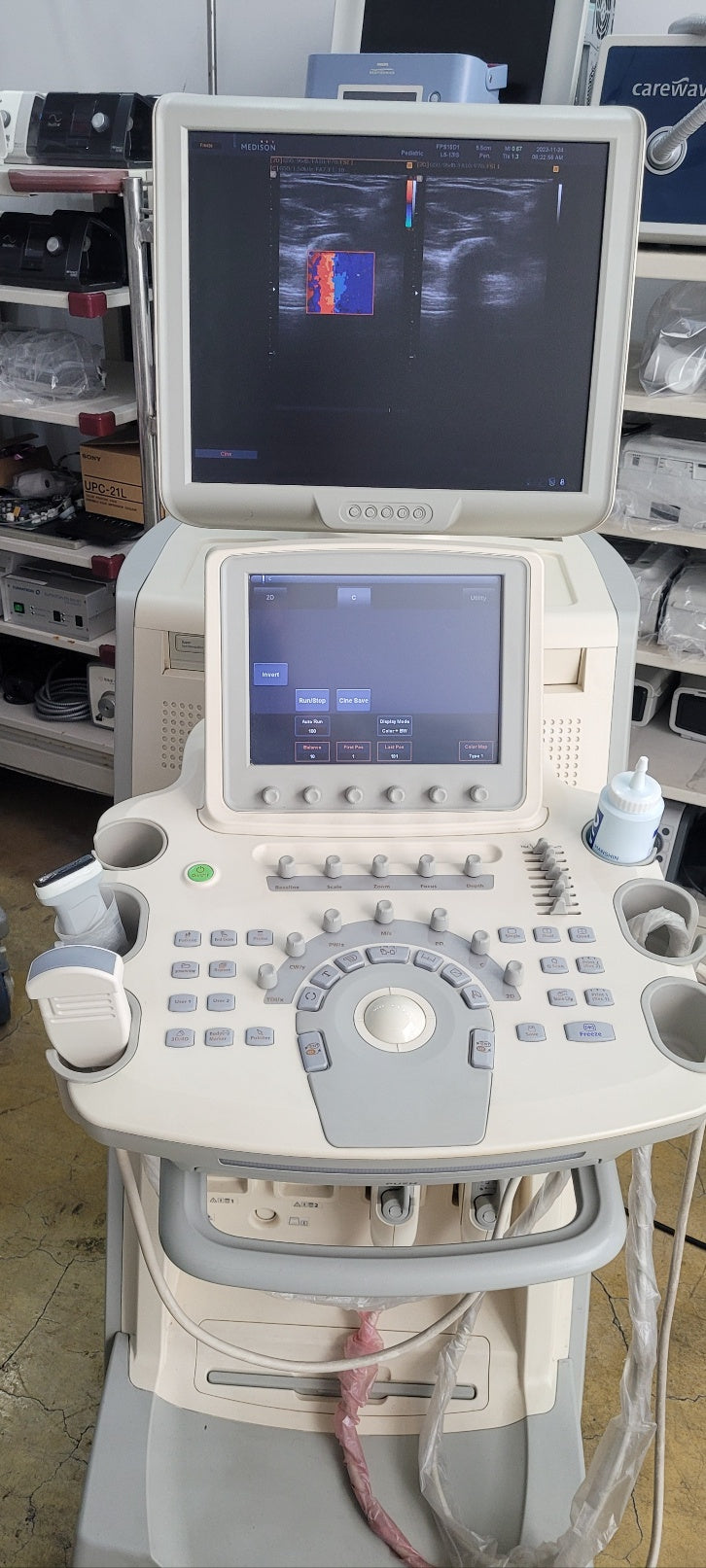 Used Medison Accuvix V20 Ultrasound with Convex Linear Probe