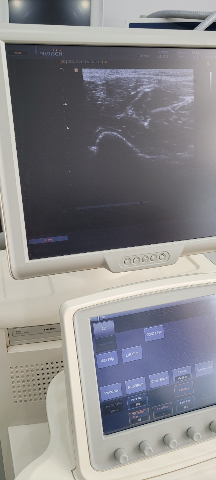 Used Medison Accuvix V20 Ultrasound with Convex Linear Probe