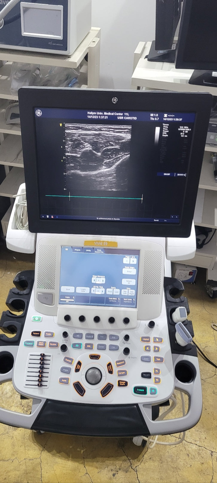 GE Vivid E9 XDClear with M5Sc Cardiac & 11L Linear 2 Probes