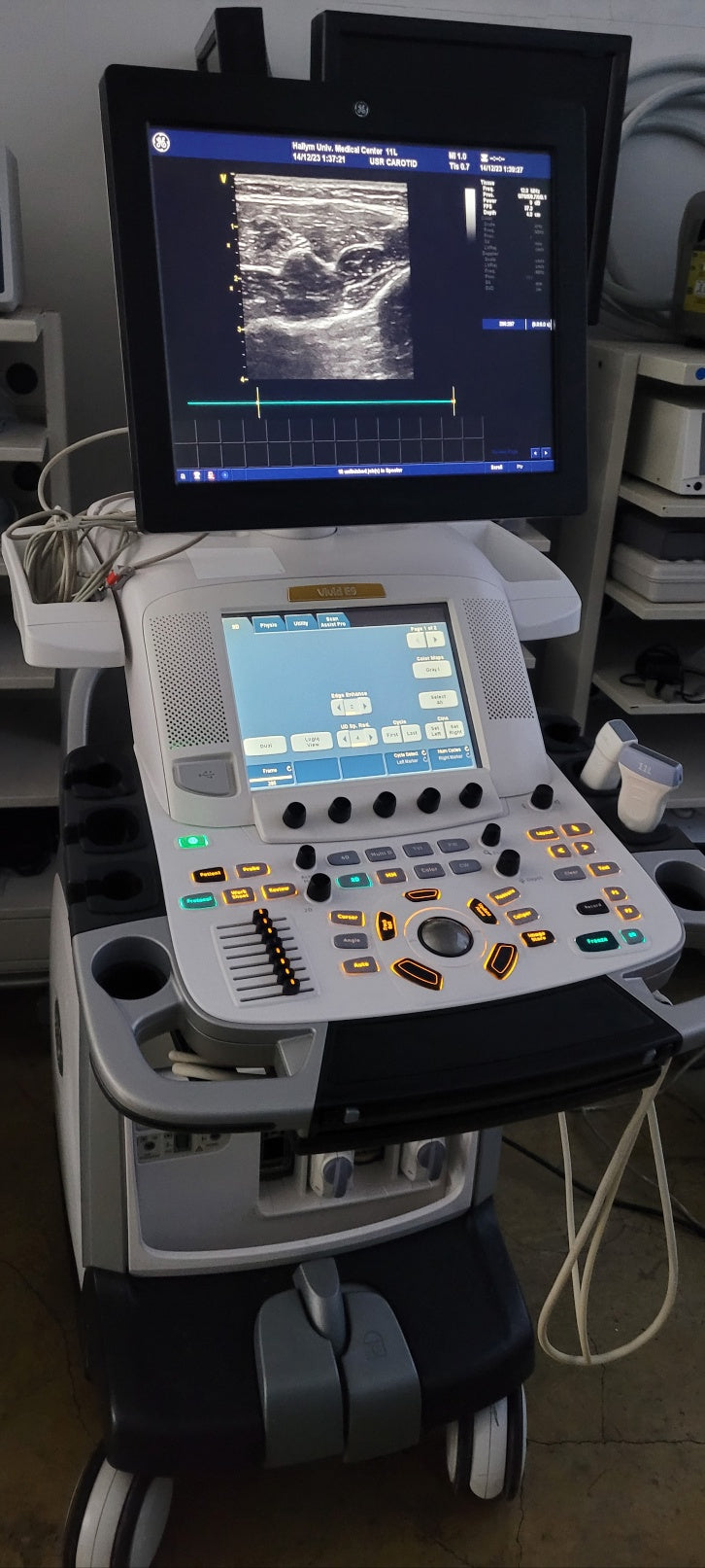 GE Vivid E9 XDClear with M5Sc Cardiac & 11L Linear 2 Probes