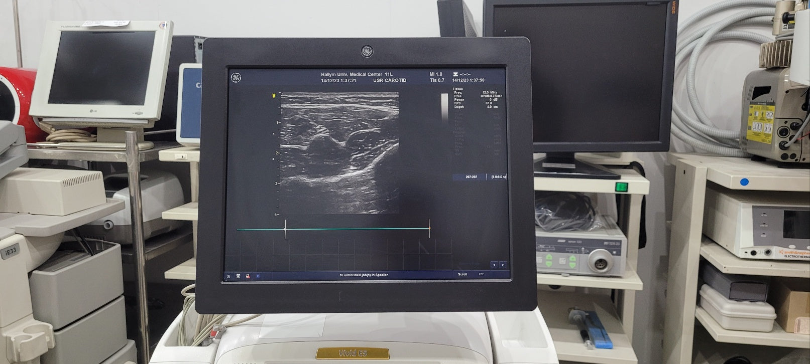 GE Vivid E9 XDClear with M5Sc Cardiac & 11L Linear 2 Probes