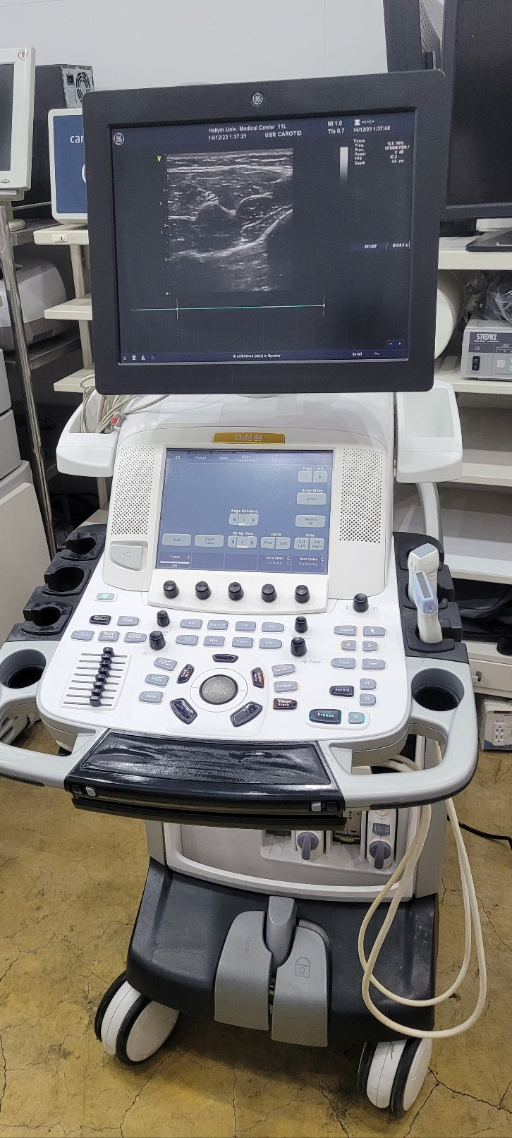 GE Vivid E9 XDClear with M5Sc Cardiac & 11L Linear 2 Probes