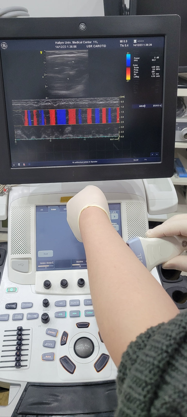 GE Vivid E9 XDClear with M5Sc Cardiac & 11L Linear 2 Probes