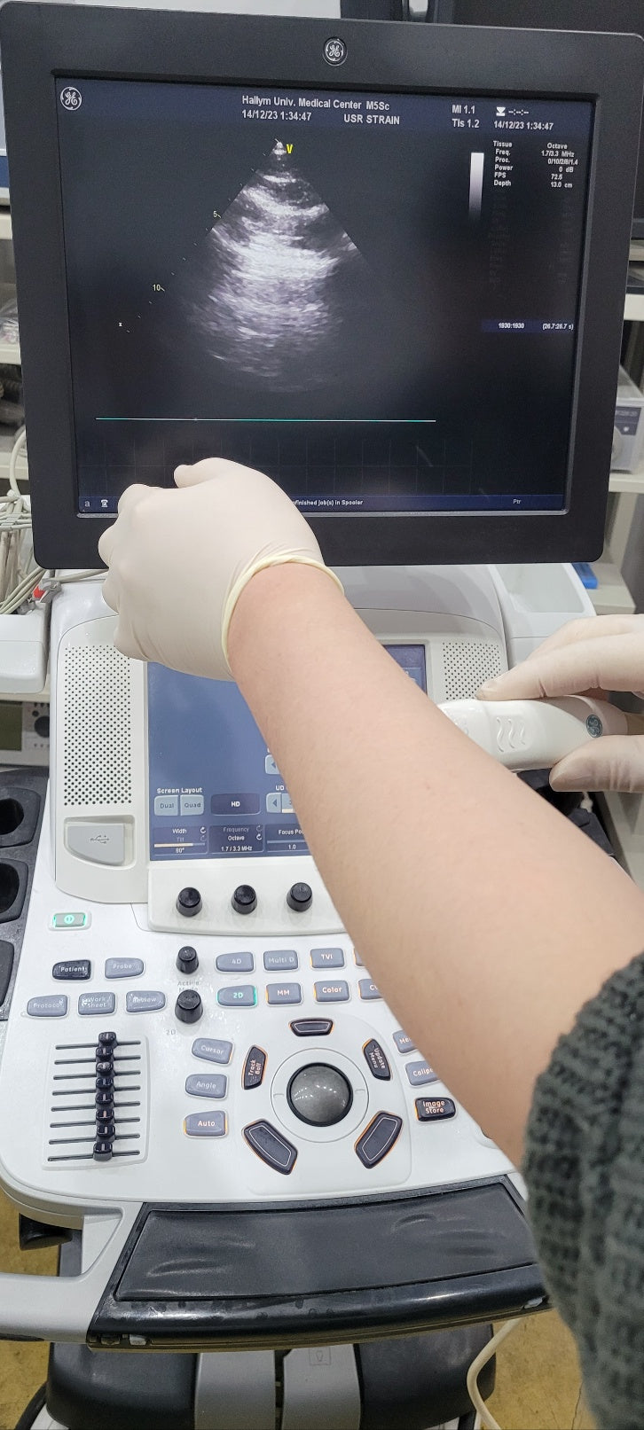 GE Vivid E9 XDClear with M5Sc Cardiac & 11L Linear 2 Probes