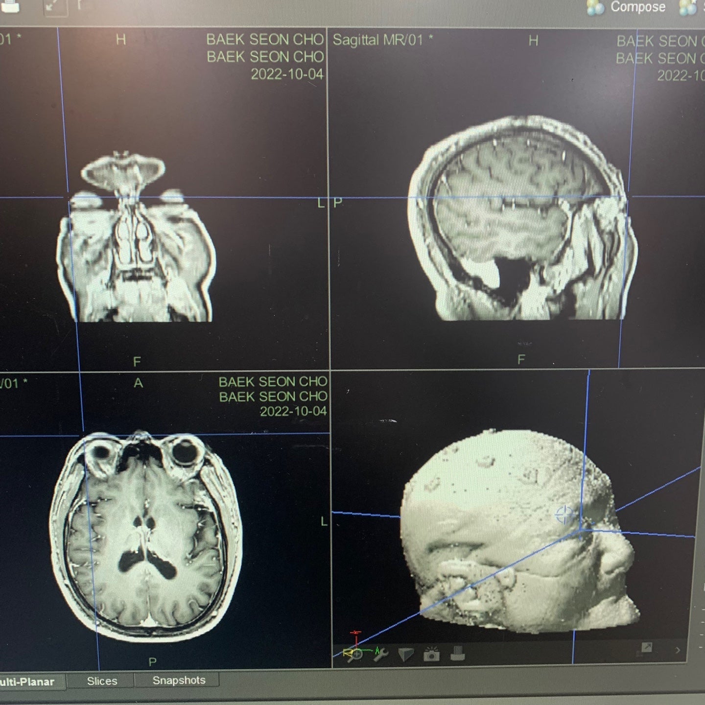 Used Stryker Navigation System