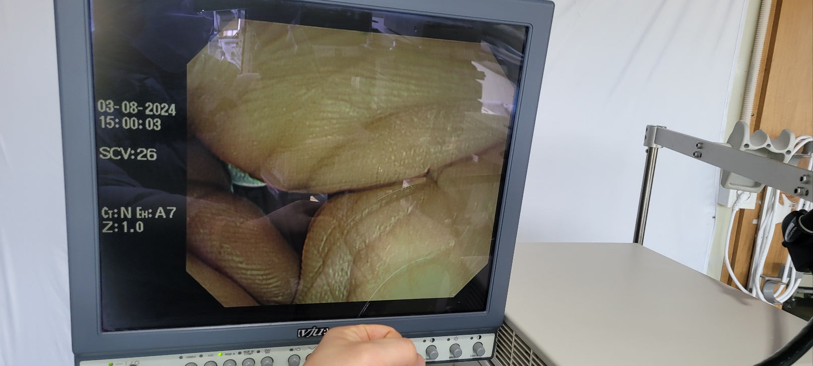 Used Olympus Gif-Q260J 9.2mm Gastroscope For Endoscopy