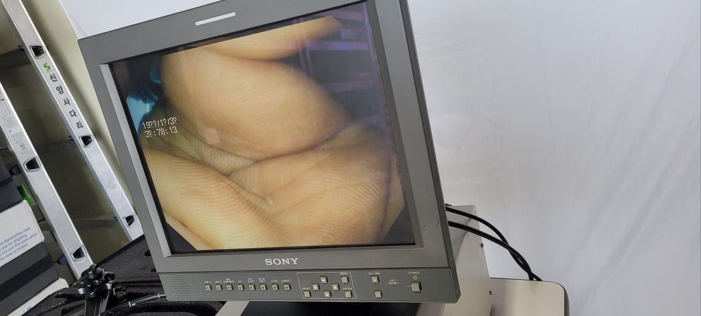 Used Olympus GIF-V70 Gastroscope With CV70 and Sony LCD Monitor