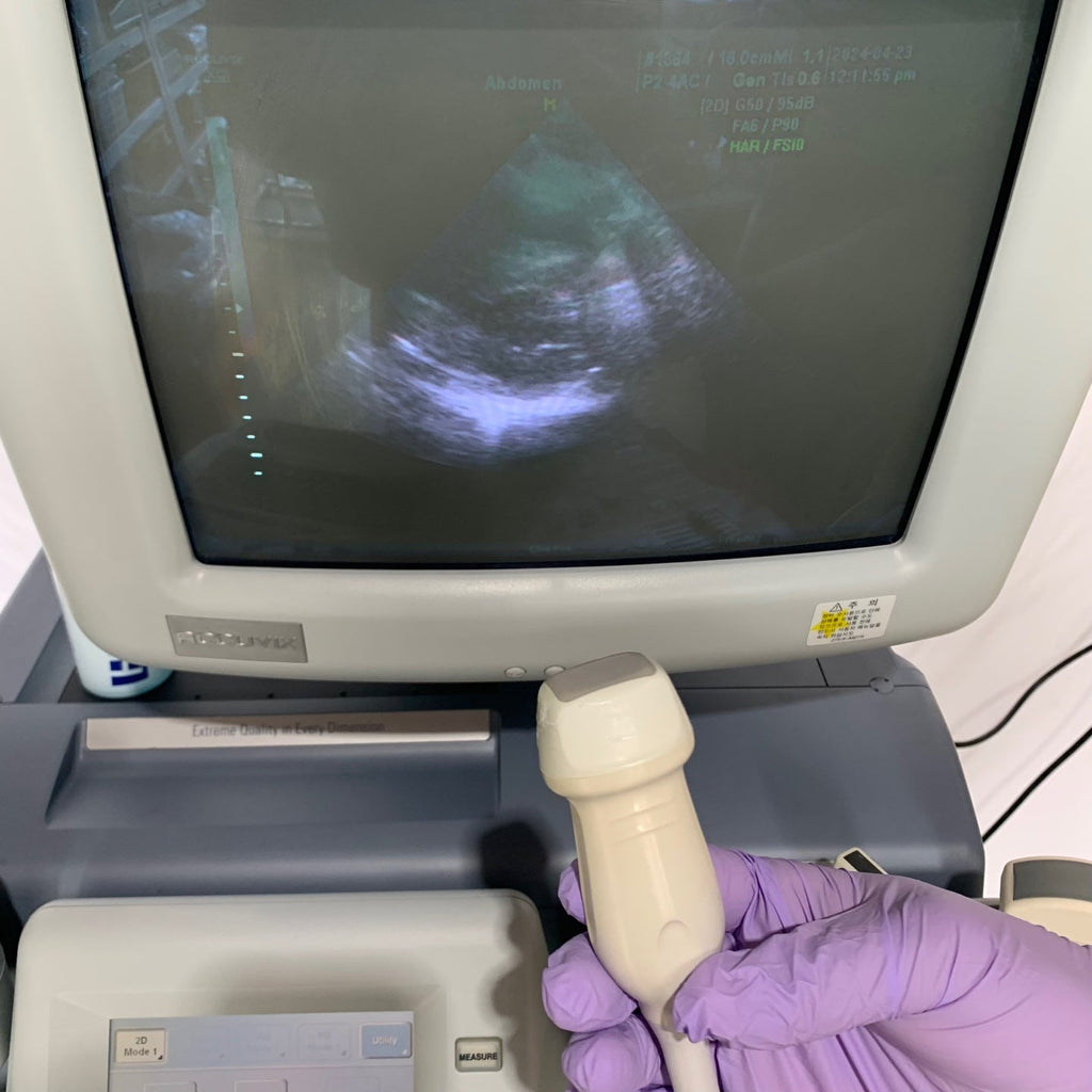 Used Medison Accuvix XQ 3D Ultrasound With 3Probes