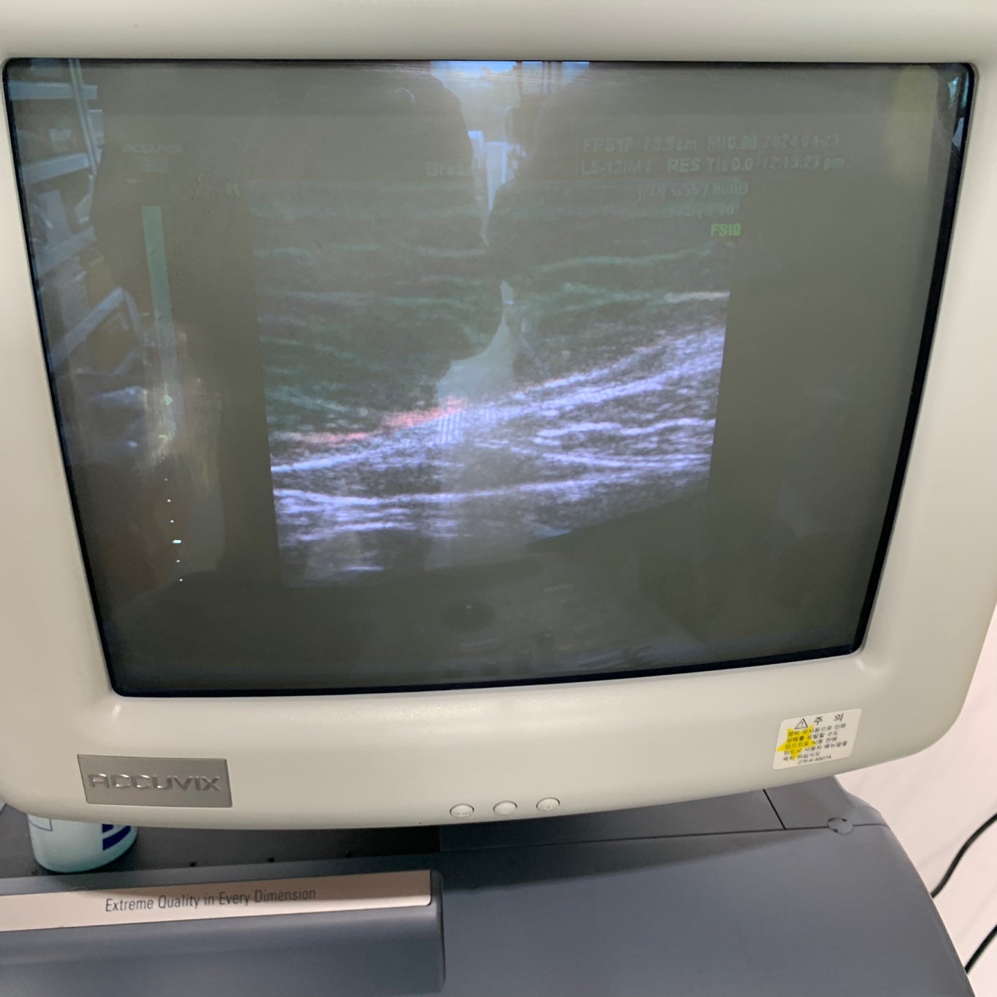 Used Medison Accuvix XQ 3D Ultrasound With 3Probes
