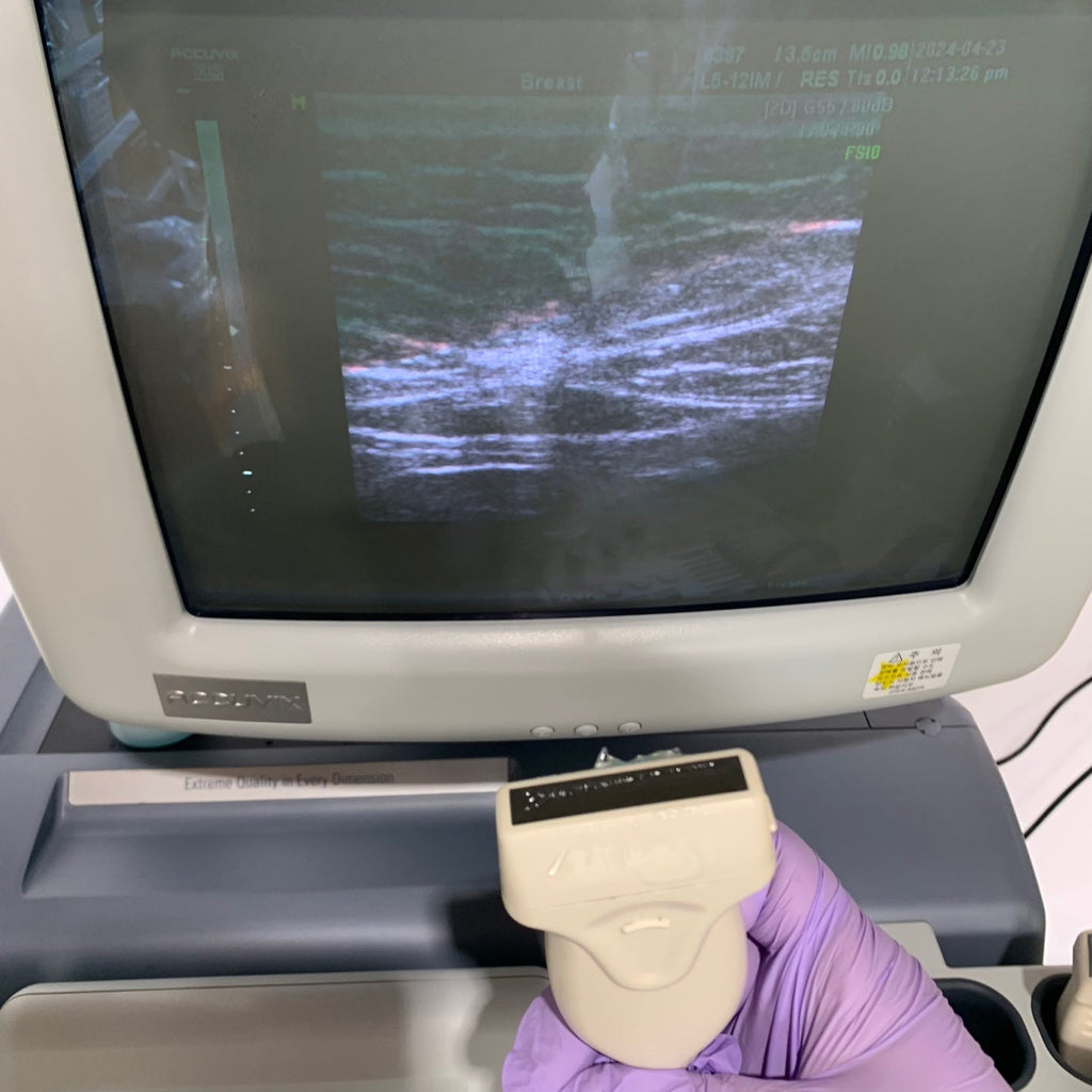 Used Medison Accuvix XQ 3D Ultrasound With 3Probes