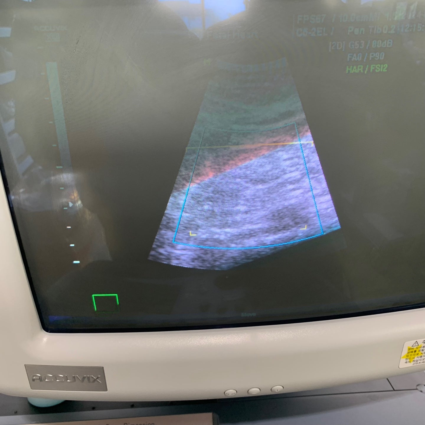 Used Medison Accuvix XQ 3D Ultrasound With 3Probes