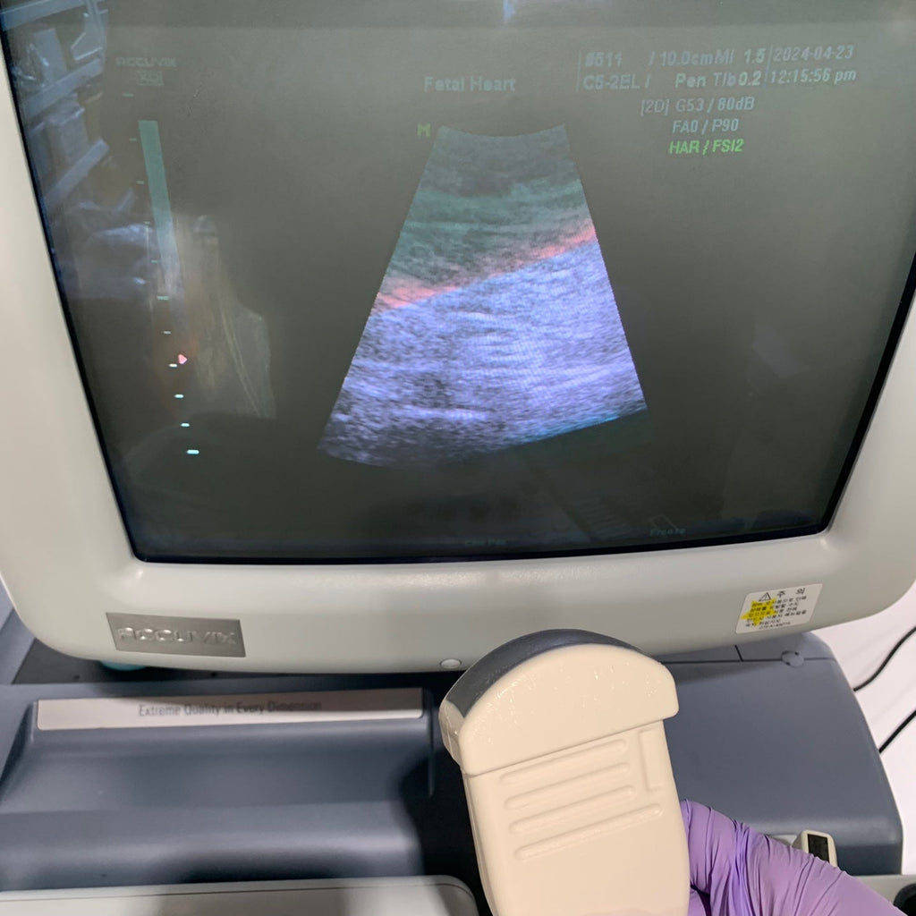 Used Medison Accuvix XQ 3D Ultrasound With 3Probes