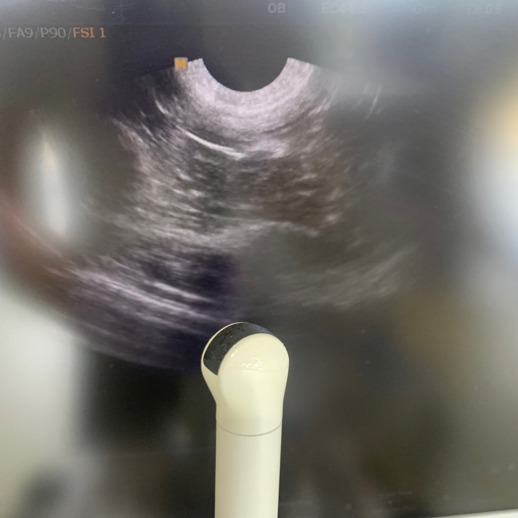 Used Medison Accuvix V10 Ultrasound with Convex Vaginal Probes
