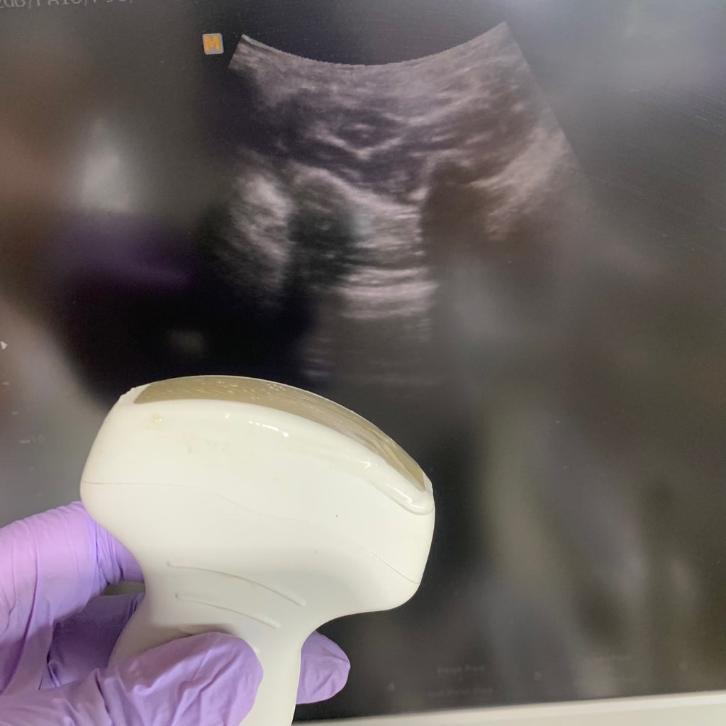Used Medison Accuvix V10 Ultrasound with Convex Vaginal Probes