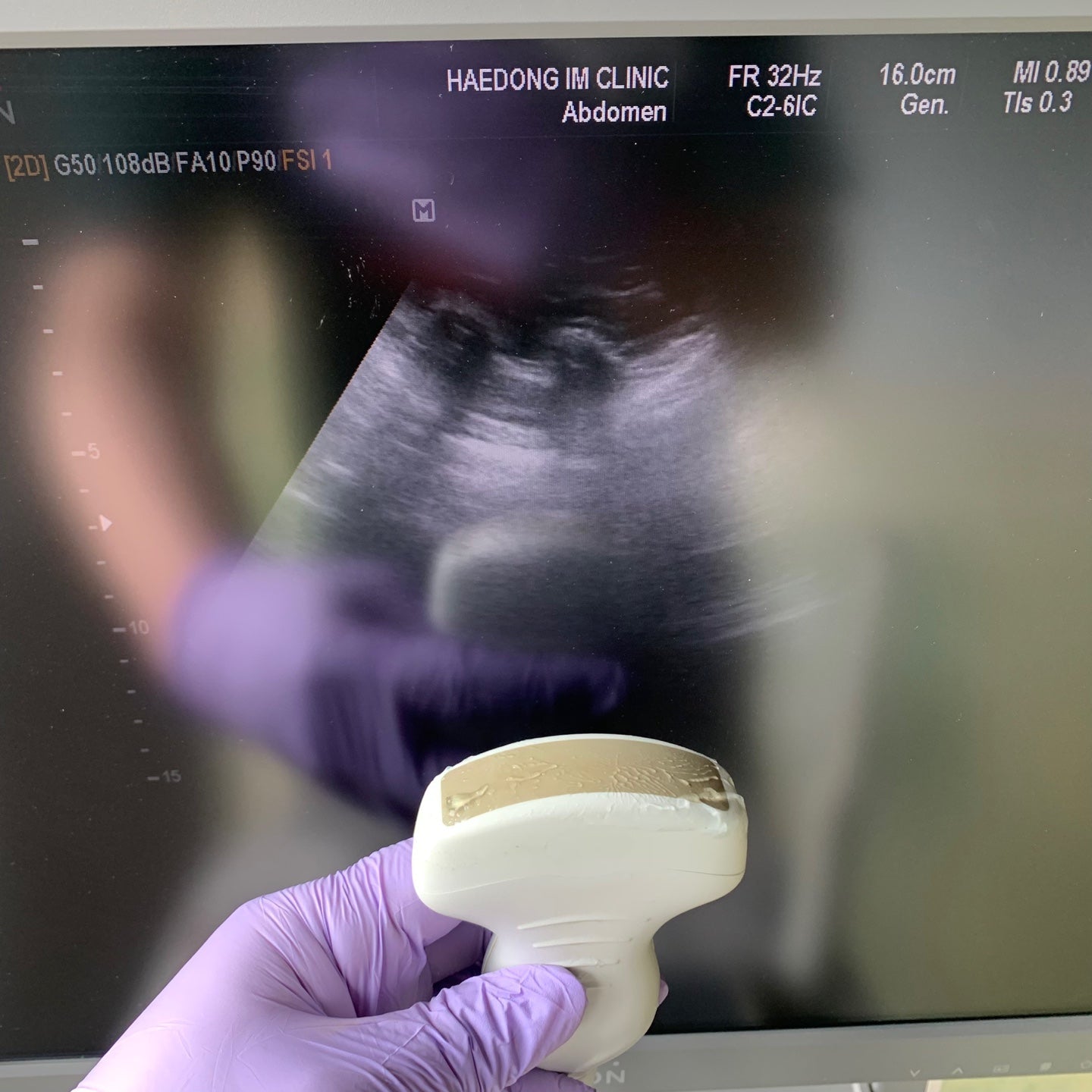Medison EKO7 Ultrasound With Cardiac and Convex Probes