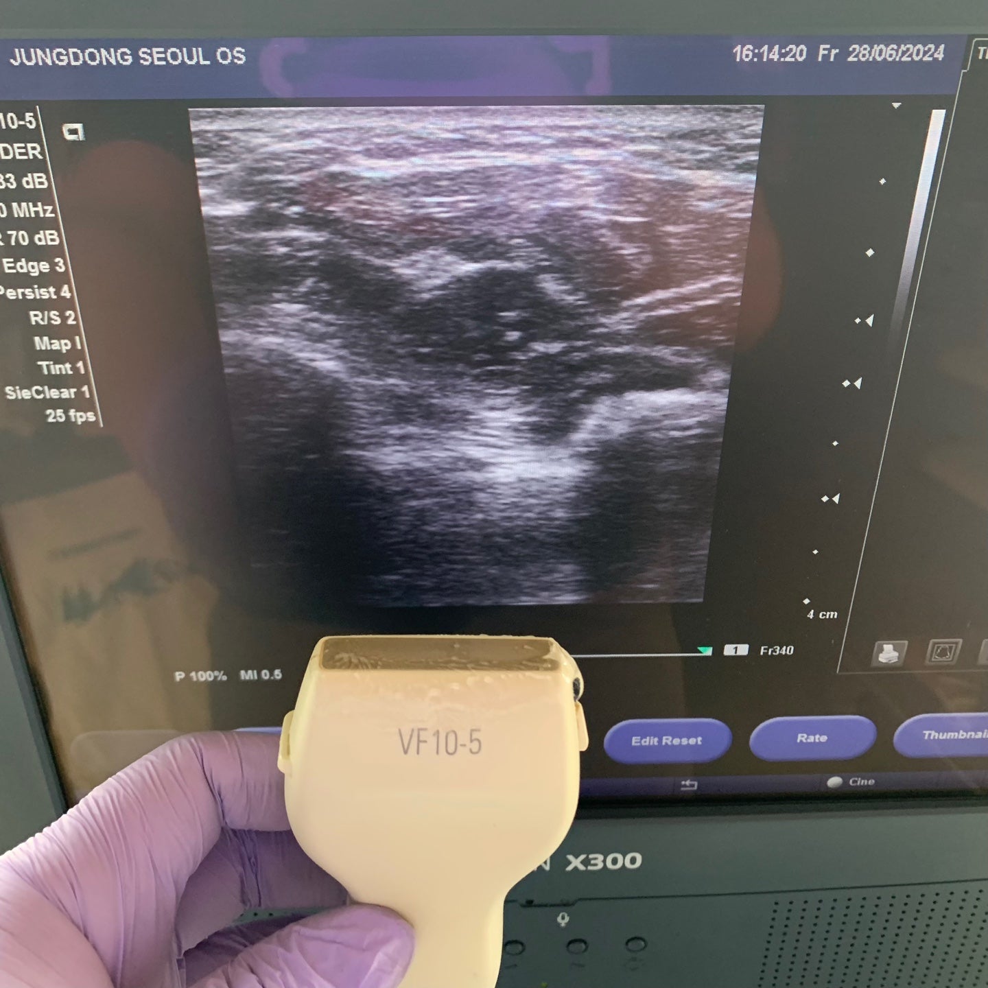 Siemens Acuson X300 with Linear Probe