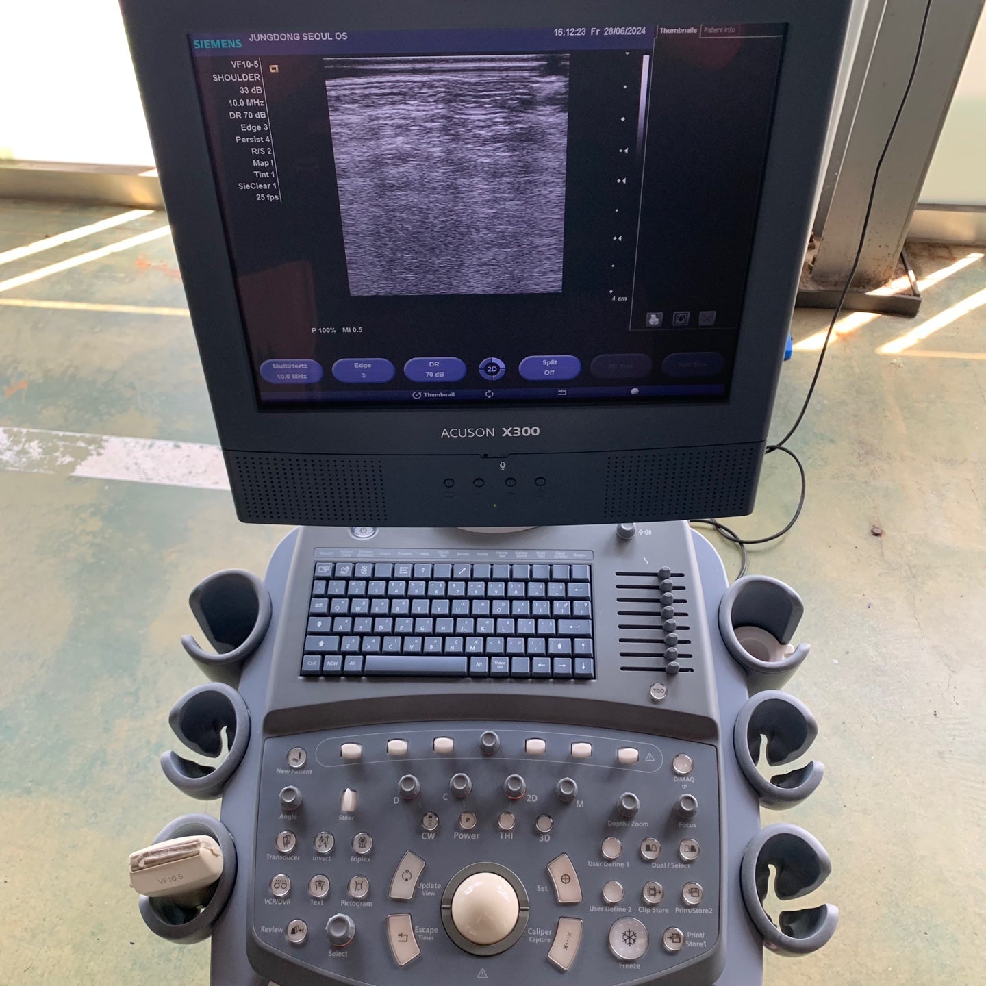 Siemens Acuson X300 with Linear Probe