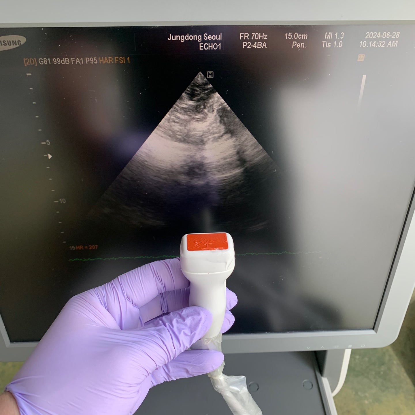 Used Samsung Medison EKO7 With Linear Cardiac and Convex 3Probes