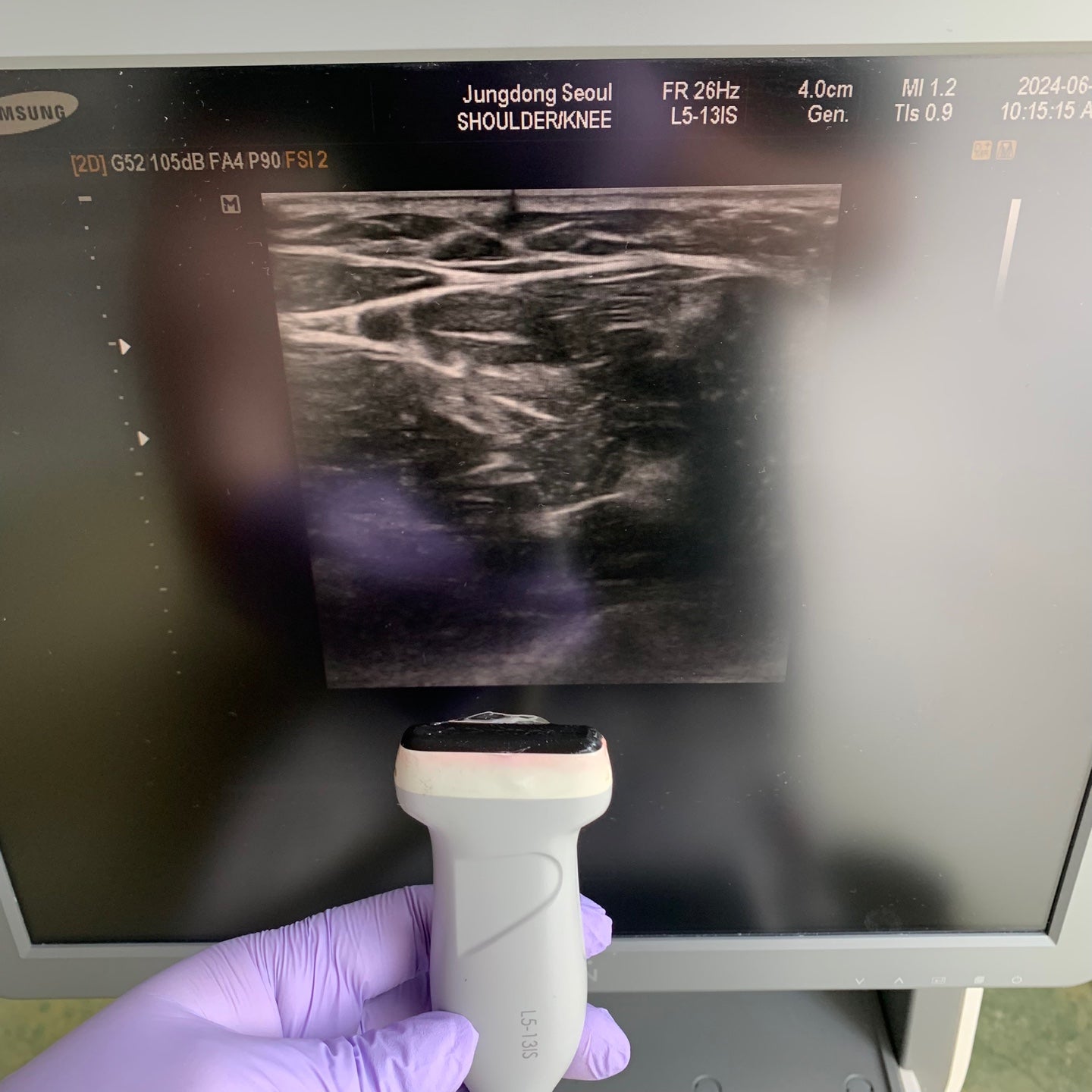 Used Samsung Medison EKO7 With Linear Cardiac and Convex 3Probes