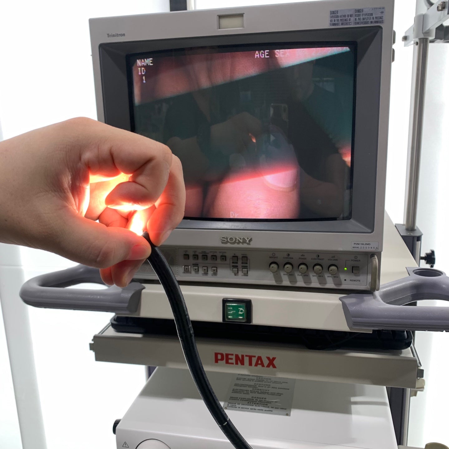 Used Pentax EPK1000 EG 2770K Endoscopy System