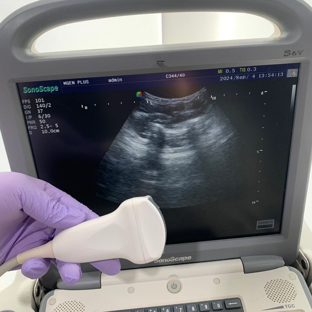 Used Sonoscape S6V Portable VET Ultrasound Convex Probe Medical