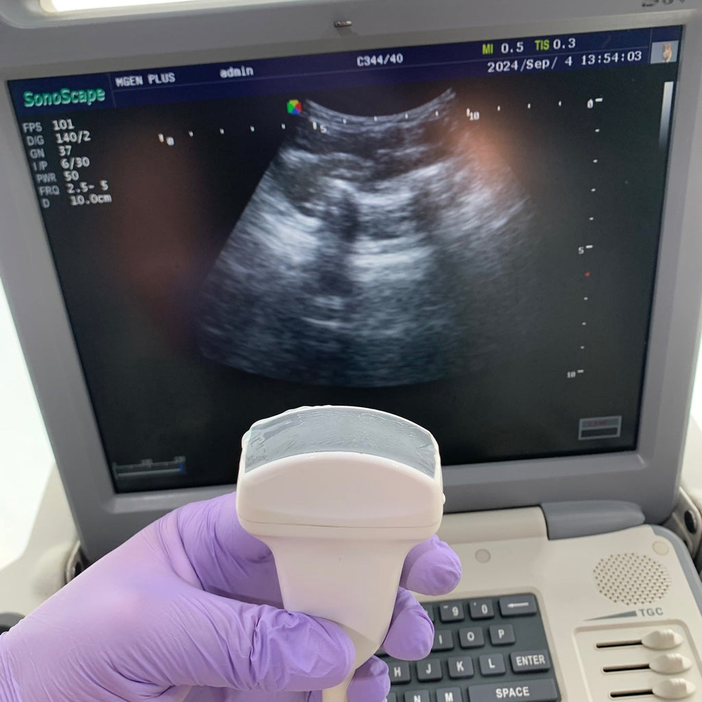 Used Sonoscape S6V Portable VET Ultrasound Convex Probe Medical