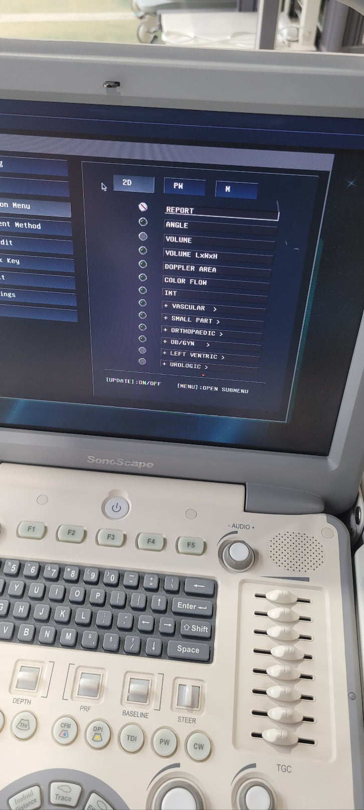 Used Sonoscape S8 Portable Ultrasound With Convex Linear Probes