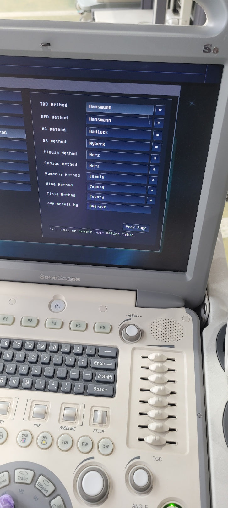Used Sonoscape S8 Portable Ultrasound With Convex Linear Probes