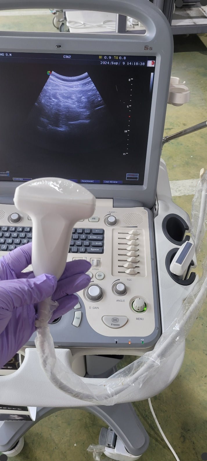 Sonoscape S8 Portable Ultrasound
