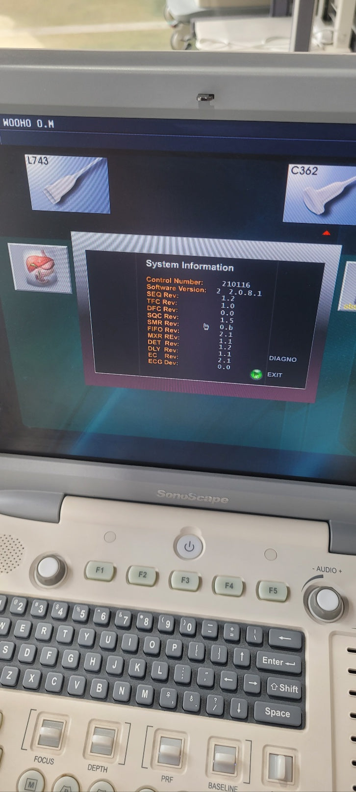Used Sonoscape S8 Portable Ultrasound With Convex Linear Probes