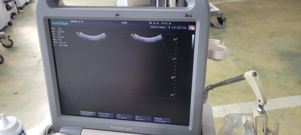 Used Sonoscape S8 Portable Ultrasound With Convex Linear Probes