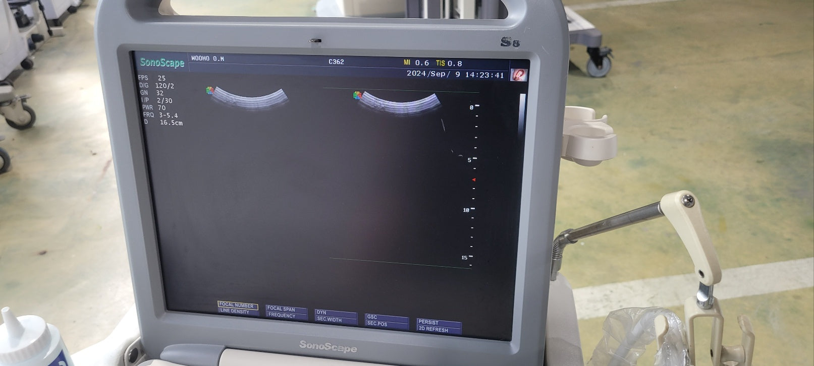 Used Sonoscape S8 Portable Ultrasound With Convex Linear Probes