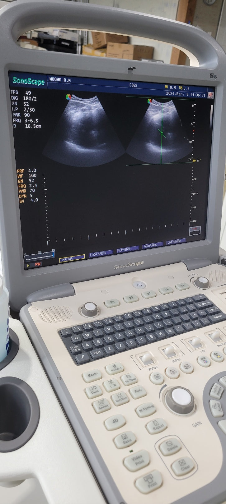 Used Sonoscape S8 Portable Ultrasound With Convex Linear Probes
