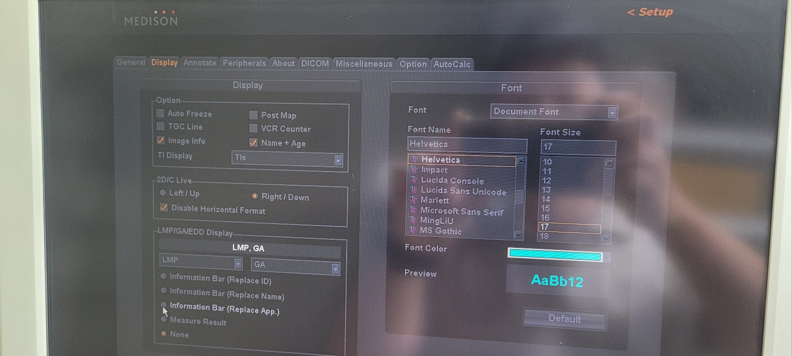 Samsung Medison Accuvix V10 Convex Linear Vaginal 3 Probes