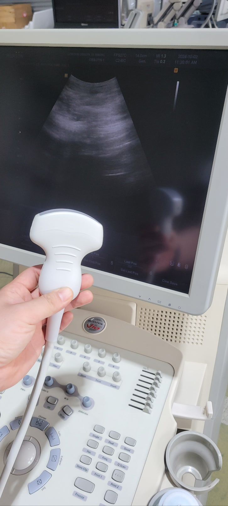 Samsung Medison Accuvix V10 Convex Linear Vaginal 3 Probes