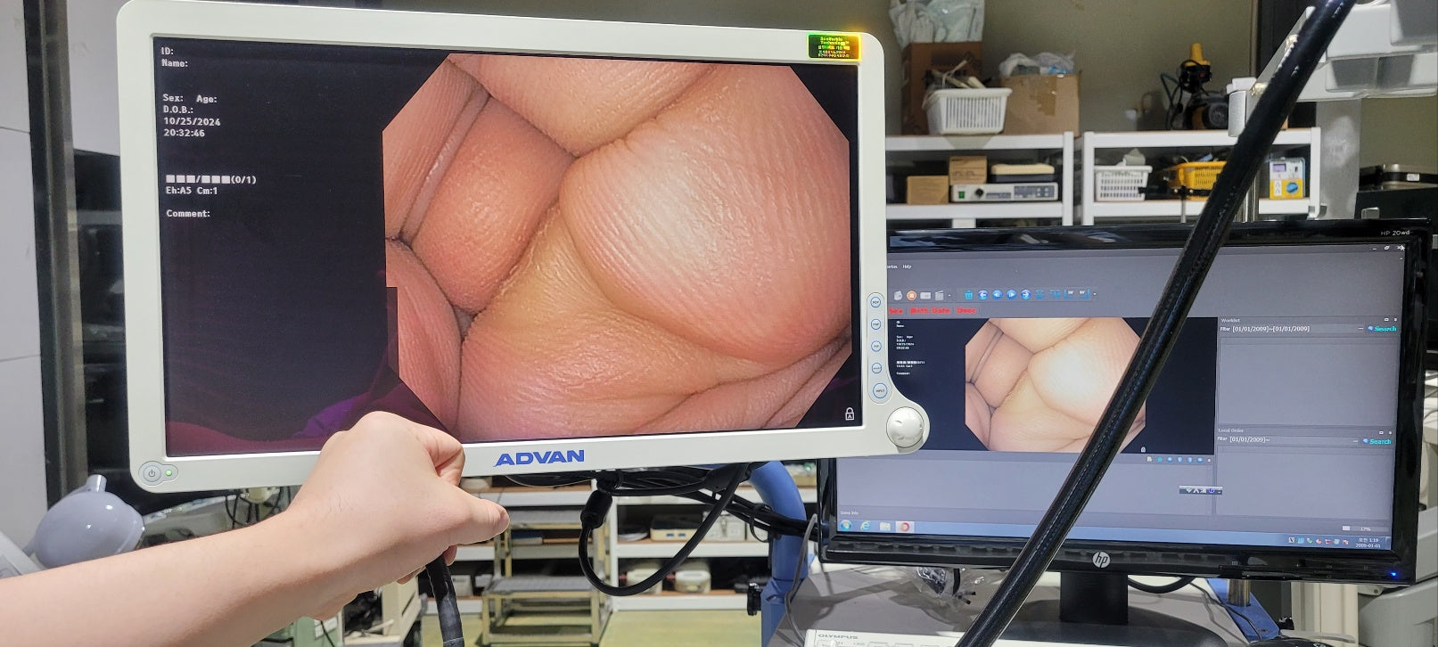 Used Olympus GIF H170 Gastroscope 9.2mm Endoscope