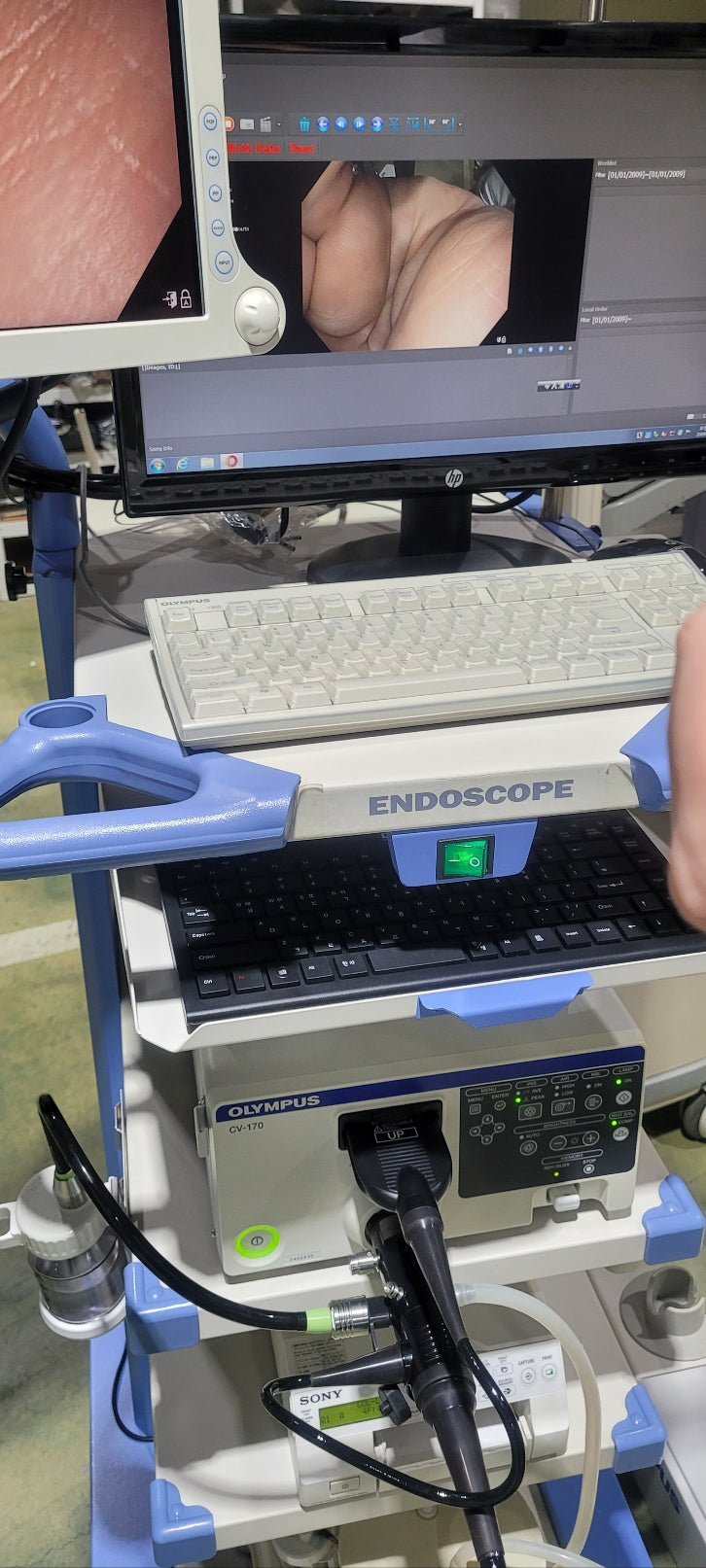 Olympus CV170 GIF H170 Gastroscope Full Endoscope System