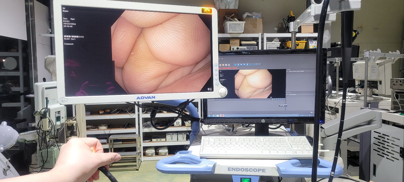 Used Olympus CV170 GIF H170 Gastroscope Full Endoscope System