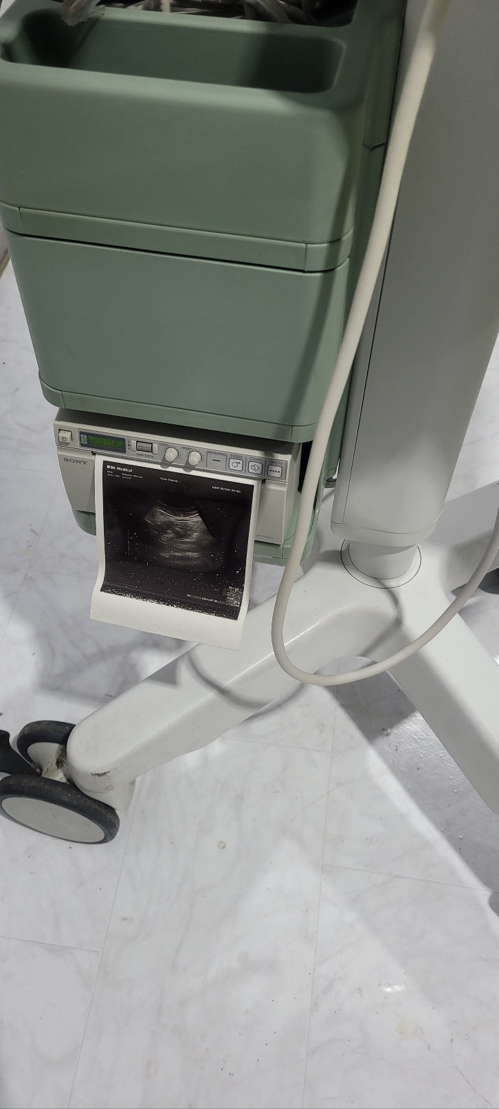Used BK MEDICAL 1202 Ultrasound With Convex Vaginal 2Probe