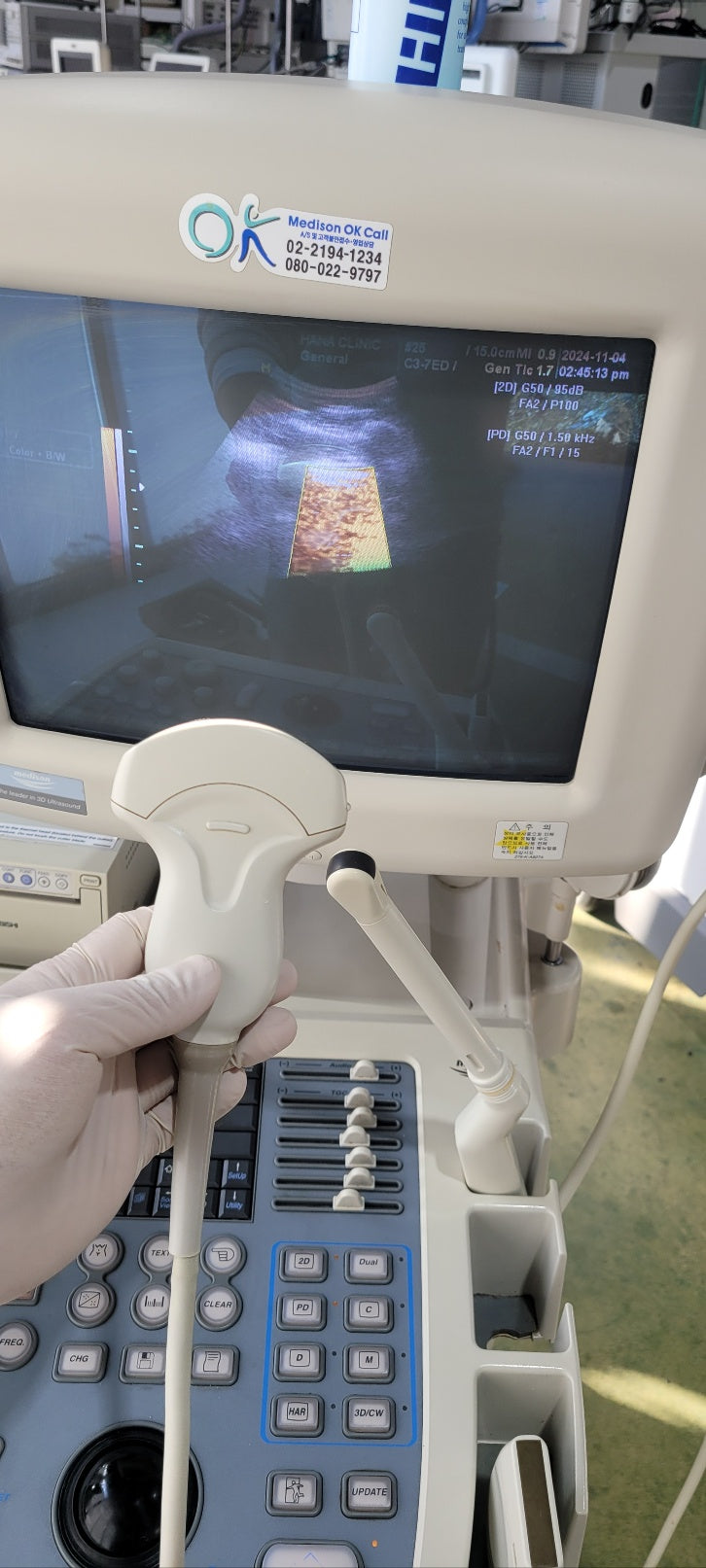 Medison Sonoace 8000 with Convex Linear Vaginal 3 Probes