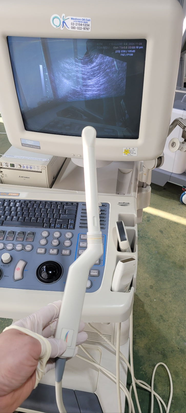 Medison Sonoace 8000 with Convex Linear Vaginal 3 Probes