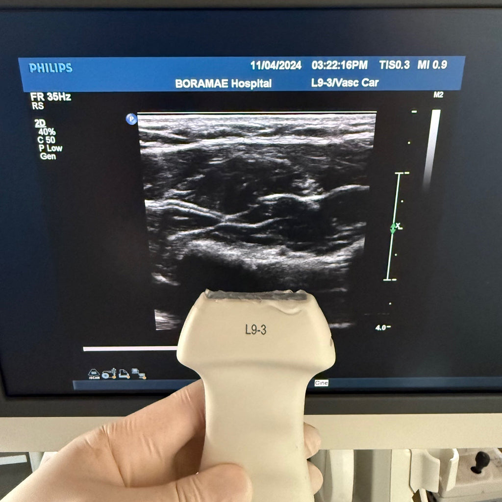 Philips IU22 with Convex & Linear 3 Probes