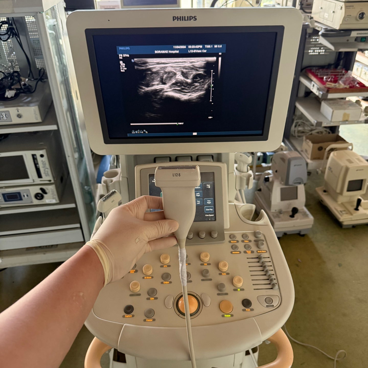Philips IU22 with Convex & Linear 3 Probes