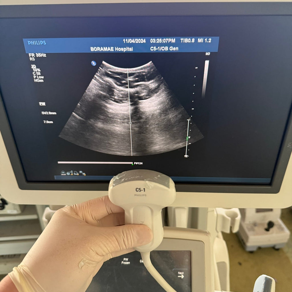 Philips IU22 with Convex & Linear 3 Probes