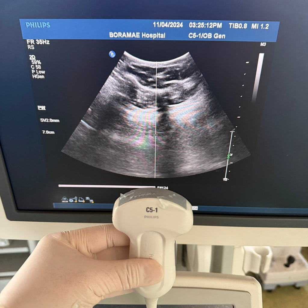 Philips IU22 with Convex & Linear 3 Probes